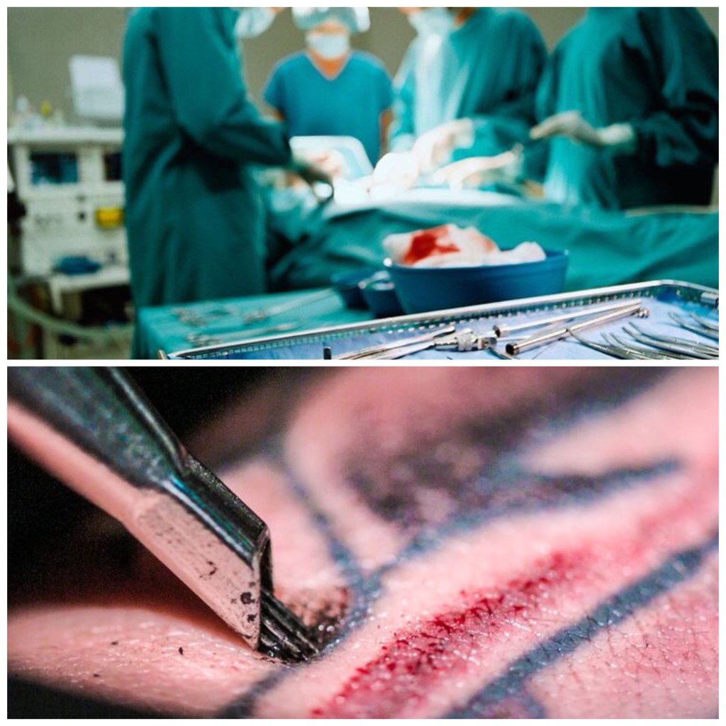 What hurts more, a tattoo or a nose job? (3 points&nbsp;Explained)